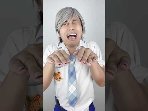 ครูตรวจเล็บ  เล็บดำ (ep.21)