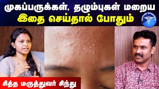 முகப்பரு நீங்க வழிகள் | பரு போக என்ன செய்ய வேண்டும் | Paru poga tips in tamil|Doctor Interview tamil