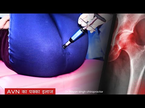 Girl avn hip treatment without surgery, hip pain relief idea, groin pain chiropractic adjustment