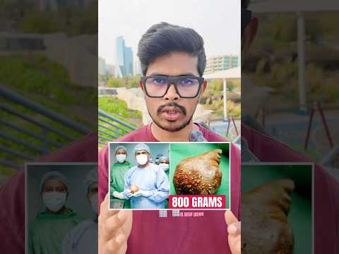 How to remove kidney stone #kidney #healthybenefits #tamilinfo #adhavanaj