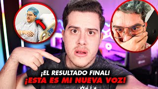 LA TRISTE VERDAD DE MI CIRUGÍA ¡ESTA ES MI NUEVA VOZ!