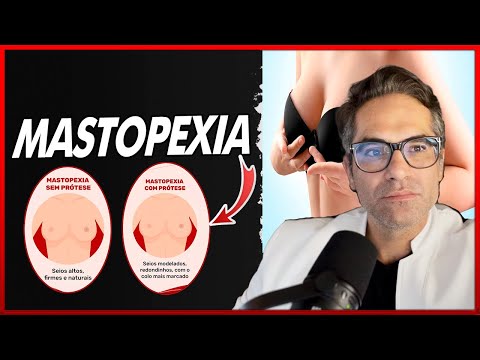 Mastopexia com ou sem Prótese: Qual é a Melhor Opção para Você?