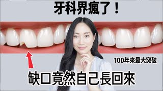 仿生科技來了！可能徹底改變牙科@DrGrace