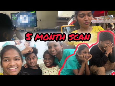 5 Month scan Nooriparthi 🤰🏻🤰🏻🥰🥰🥰🔥🔥🔥￼