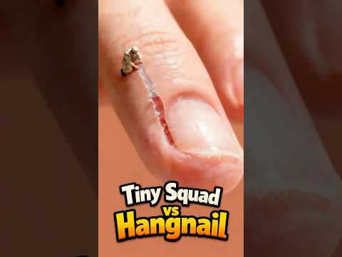 Tiny Squad vs Hangnail