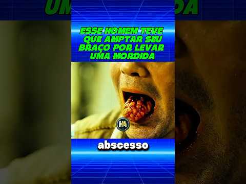 Ele teve que amputar o braço #series #filmes #shorts #shortsviral #movie