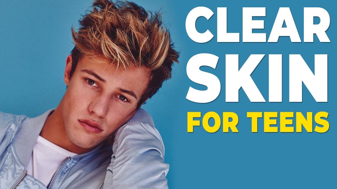How To GET RID OF ACNE for Teens - Clear Skin FAST 2020 - Alex Costa