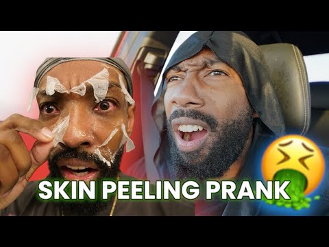 DISGUSTING SKIN PEELING PRANK ON MY BROTHER! | VLOGMAS DAY 11