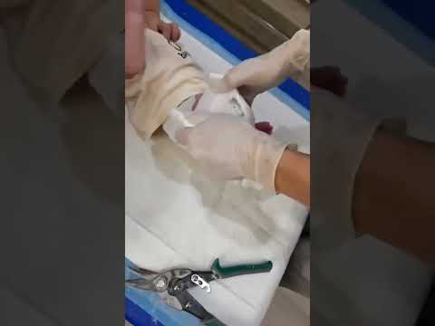 一个礼拜换一次石膏,每剪一下我都害怕😱😭,怕伤到我的心肝宝贝❤️愿求大慈大悲观世音菩萨保佑宝贝快点好起来😭,#保佑 #分享 #正能量 南无阿弥陀佛🙏🙏🙏