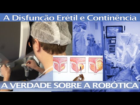 Câncer de Próstata e a Cirurgia por Robô