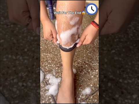Clean Unwanted Hair At Home Easily | Easy Hair Removal Pack #trending #shortsyoutube #video #shorts
