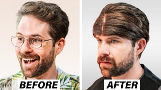 Me Arrepiento de mi Trasplante de Cabello Turco