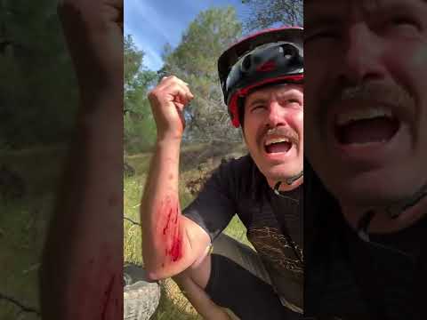 You Crashed? How’s the Bike!! 🚲 💥