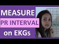 Measuring PR Interval in EKGs