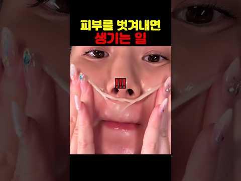 피부를 벗겨내면 생기는 일