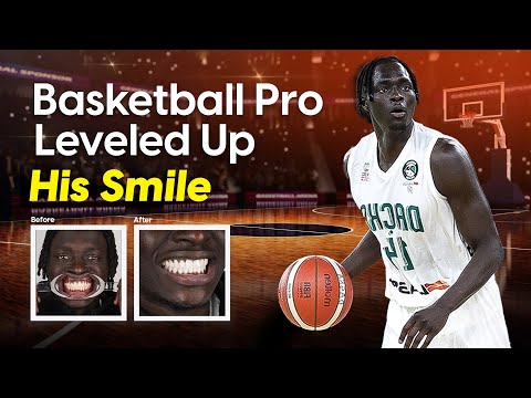 Both Tut’s Smile Makeover in Istanbul 🏀⛹