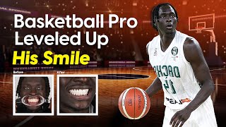 Both Tut’s Smile Makeover in Istanbul 🏀⛹