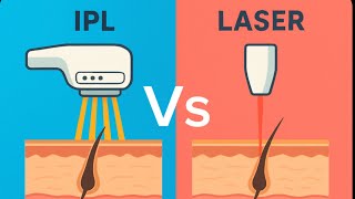 #Laser vs IPL Level4 explained in Tamil#04-Dec- 2025# yt#Tamil vlog#part1# london