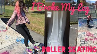 I Broke My Leg Roller Skating: My Broken Bone Story