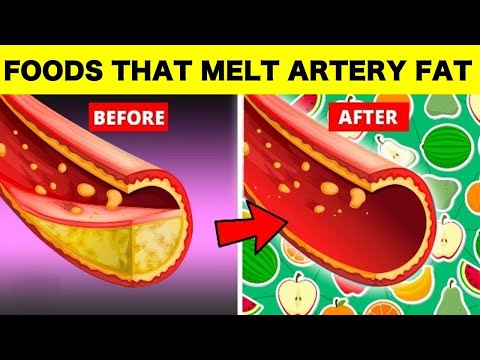 Cardiologists Hate This! Top 7 Foods That Naturally Melt Away Artery Blockages!