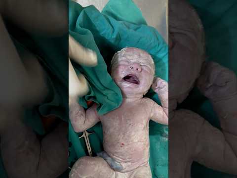 Cute baby moments #cute #baby #youtubeshorts #pregnancy #babycrying #emotional #birthjourney
