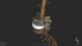 MATHIS LOYD Lumbar 08 07 2021 | Pines Salomon Personal Injury Lawyers