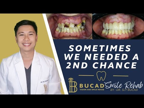 "Sometimes We Need a 2nd Chance" Best Dental Optical Clinic Manila Philippines