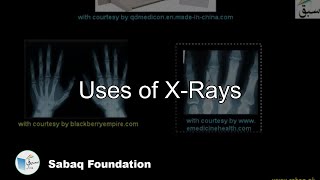 Uses of X-Ray