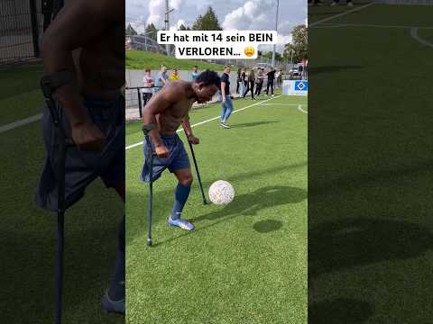 Er hat mit 14 sein BEIN VERLOREN.. ? #shorts #jannikfreestyle