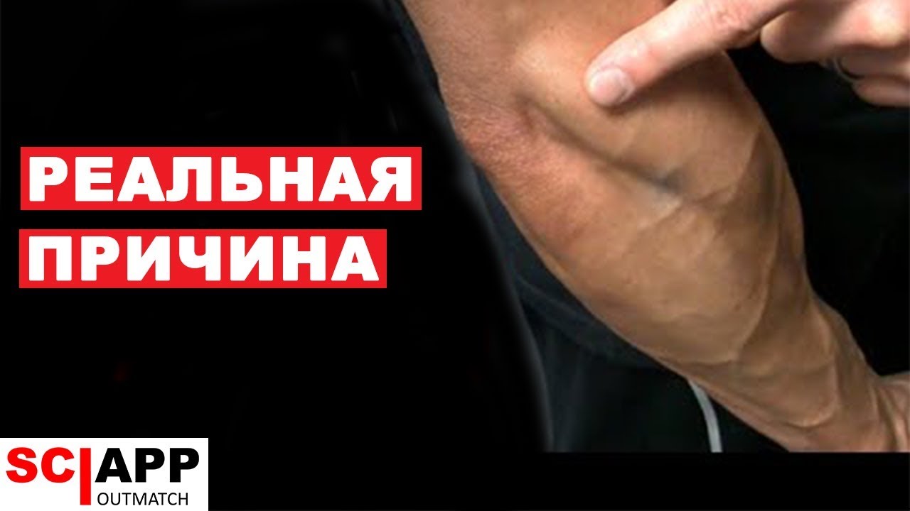 Правда О Локте Теннисиста - Причина Боли В Локте И Как От Нее Избавиться