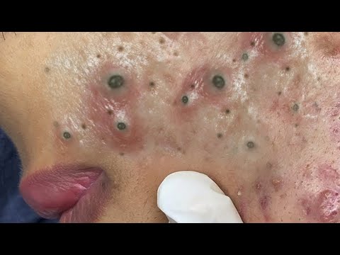 كيفية الحفاظ على نظافة الوجه يومياBT7880