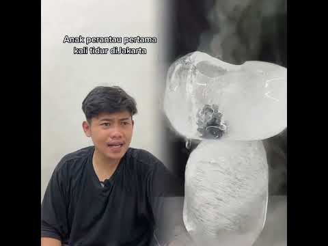 #pov #foryou #funny #acting #story #foryoupage#viral #skit #fyp シ #duet #tools  #fyp