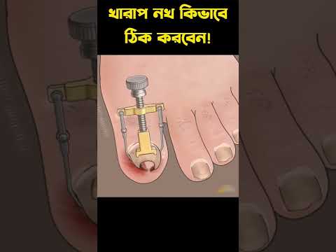 খারাপ নখকে কিভাবে ঠিক করবেন #ytshorts #shorts
