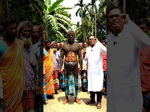 মৌচাক তৈরি হলো মানুষের গায়ে