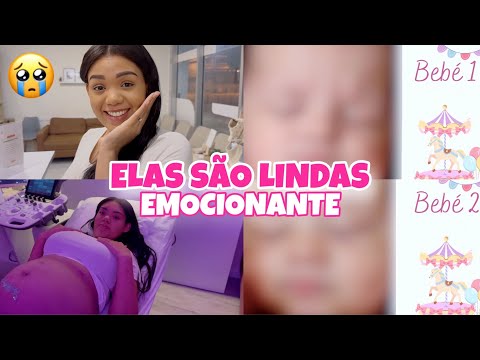VIMOS OS ROSTINHOS DAS GÊMEAS PELA PRIMEIRA VEZ 😍 ULTRASSOM 8K - EMOCIONANTE 😭