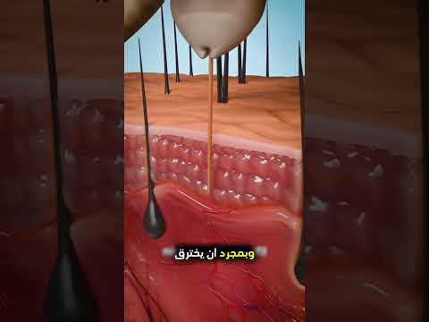 إذا كان لديك قمل في شعرك... انتبه جيدًا! 😮😥🤔
