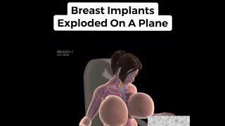 Worst/Dumbest Ways People Have Died 😱 Shorts Compilation (Jacob Boy69)