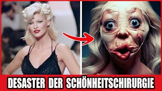 Ein Einziger Schnitt, Alles Verloren: 13 Tragische Schönheitsoperationen In Hollywood!