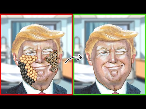 ASMR Remove Maggots & Dog Ticks Severely Injured Treatment Animation From Donald Trump