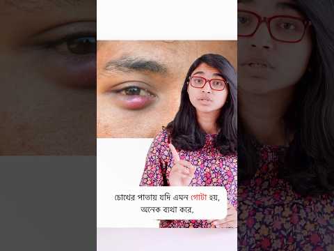 চোখের পাতায় অঞ্জনি হলে করণীয়