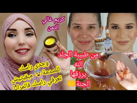 لكل وحدة عقدها الوجه ديالها وفقدات الأمل🥹نساي الكلف وآثار الحبوب والتجاعيد غادي يردك لشبابك💃