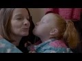 Understanding Cerebral Palsy