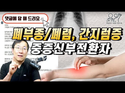 말기신부전 (투석)환자: 폐부종/폐렴, 간지럼증