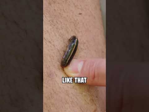 How to REMOVE A LEECH from your skin!