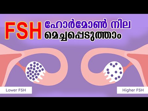 FSH  ഹോര്‍മോണ്‍ കുറയുന്നതും കൂടുന്നതും ഗര്‍ഭ ധാരണത്തെ ബാധിക്കും FSH hormone levels in female
