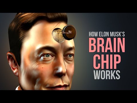 How the Neuralink N1 Brain Chip Works! (Animation)