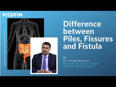 What is the difference between Piles, Fissures and Fistula?