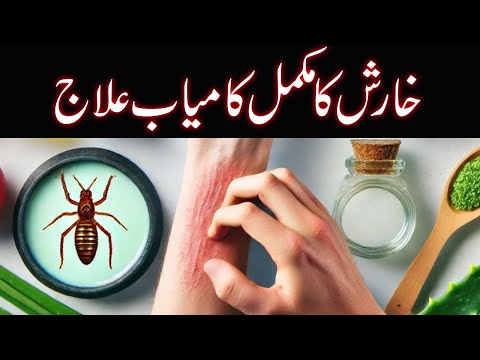 Kharish (Scabies) Ka Fori Asaan Ilaj | Scabies Treatment in Urdu