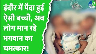 Indore: दो सिर, चार हाथ वाली अनोखी बच्ची का जन्म, पहले भी पैदा हो चुका है ऐसा बच्चा