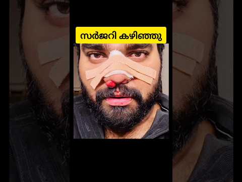 ഡോക്ടർ റോബിൻ രാധാകൃഷ്ണ നെ കണ്ടു ഞെട്ടി😱😱 #trending #robinradhakrishnan #drrobin #biggboss #couple